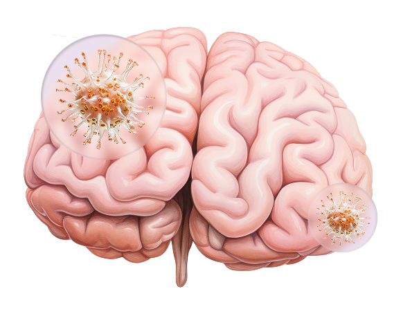 Brain with Virus Illustration